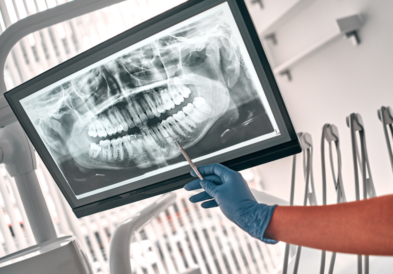 Dental X-Ray Singapore