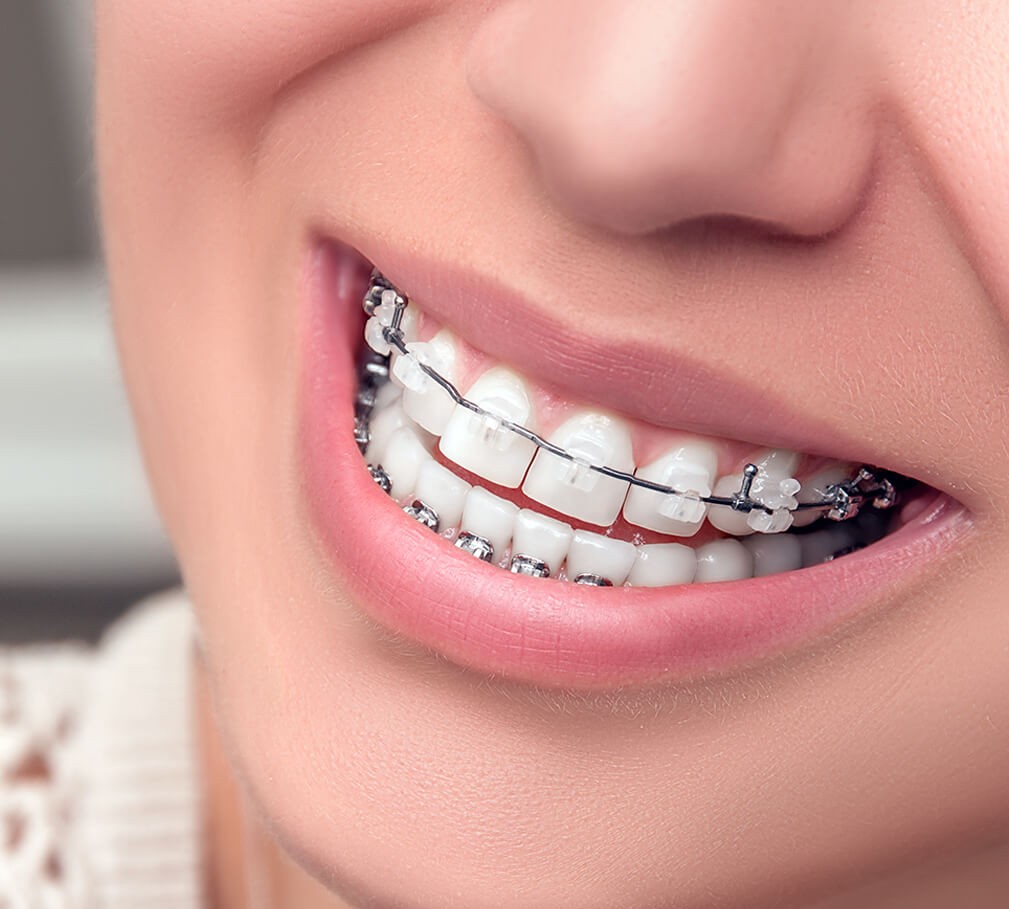 SG Dental Check-up 2026